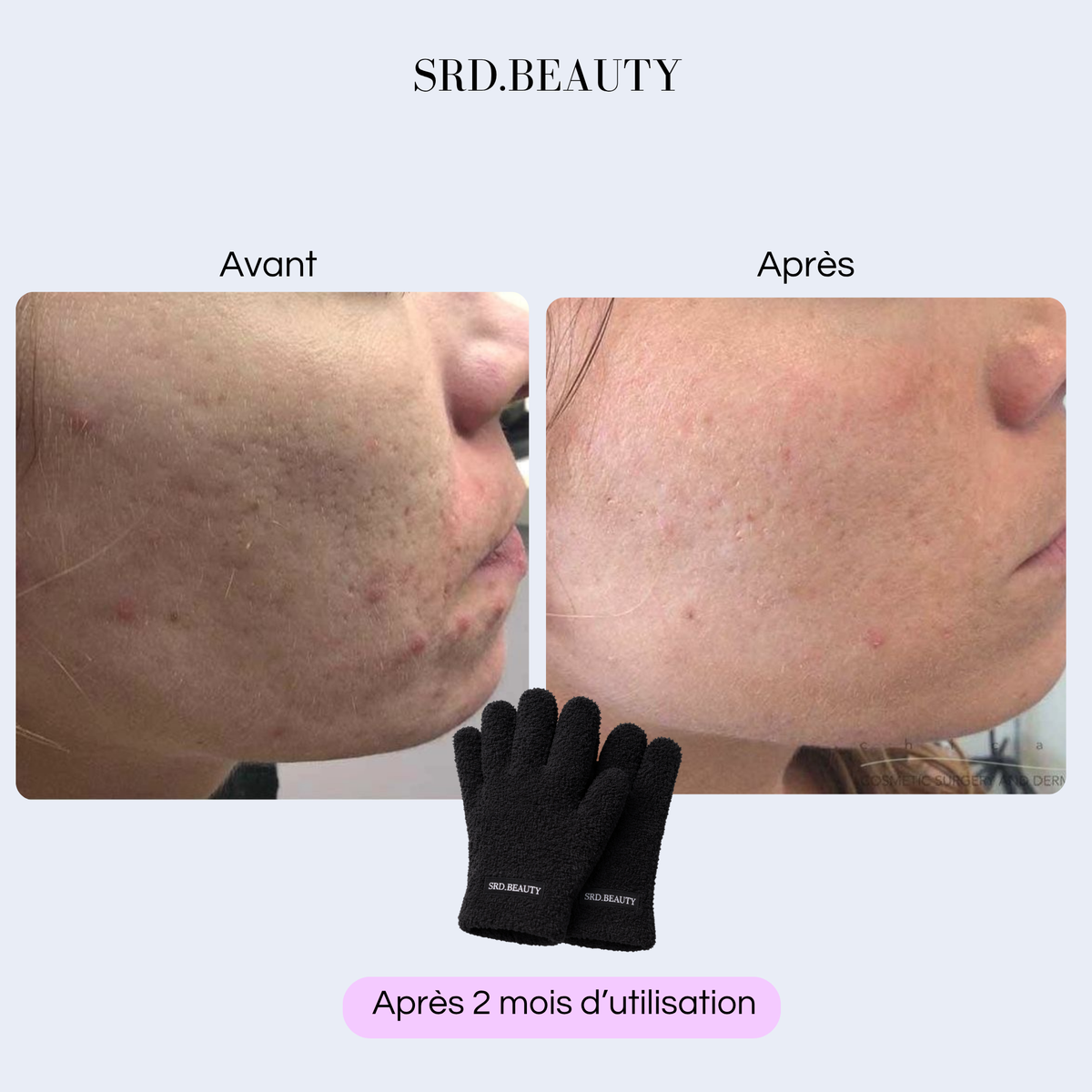 Gant Démaquillant Réutilisable - Rose